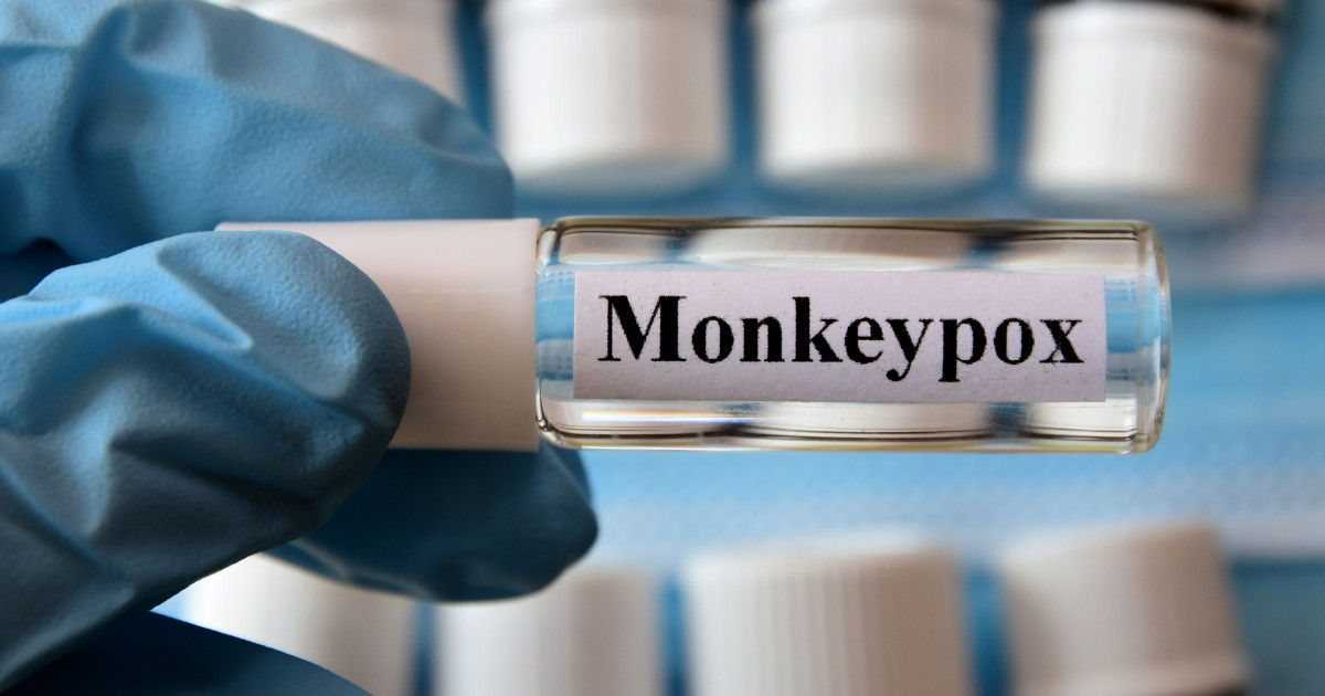 How and where to get vaccinated in Madrid for monkeypox